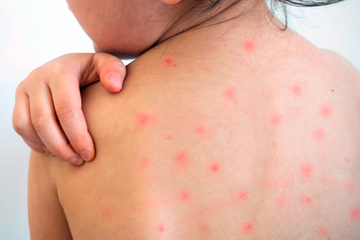 Seis entrerrianos en control.