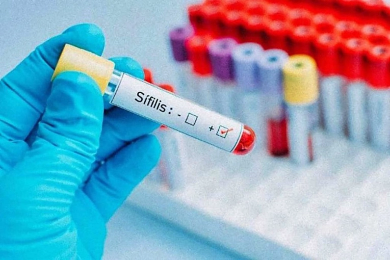 SÍFILIS: La tasa de notificación provincial aumentó más del 70% interanual y superó el promedio nacional