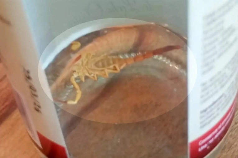 Un niño fue atendido de urgencia en el hospital tras ser picado por un alacrán mientras se bañaba