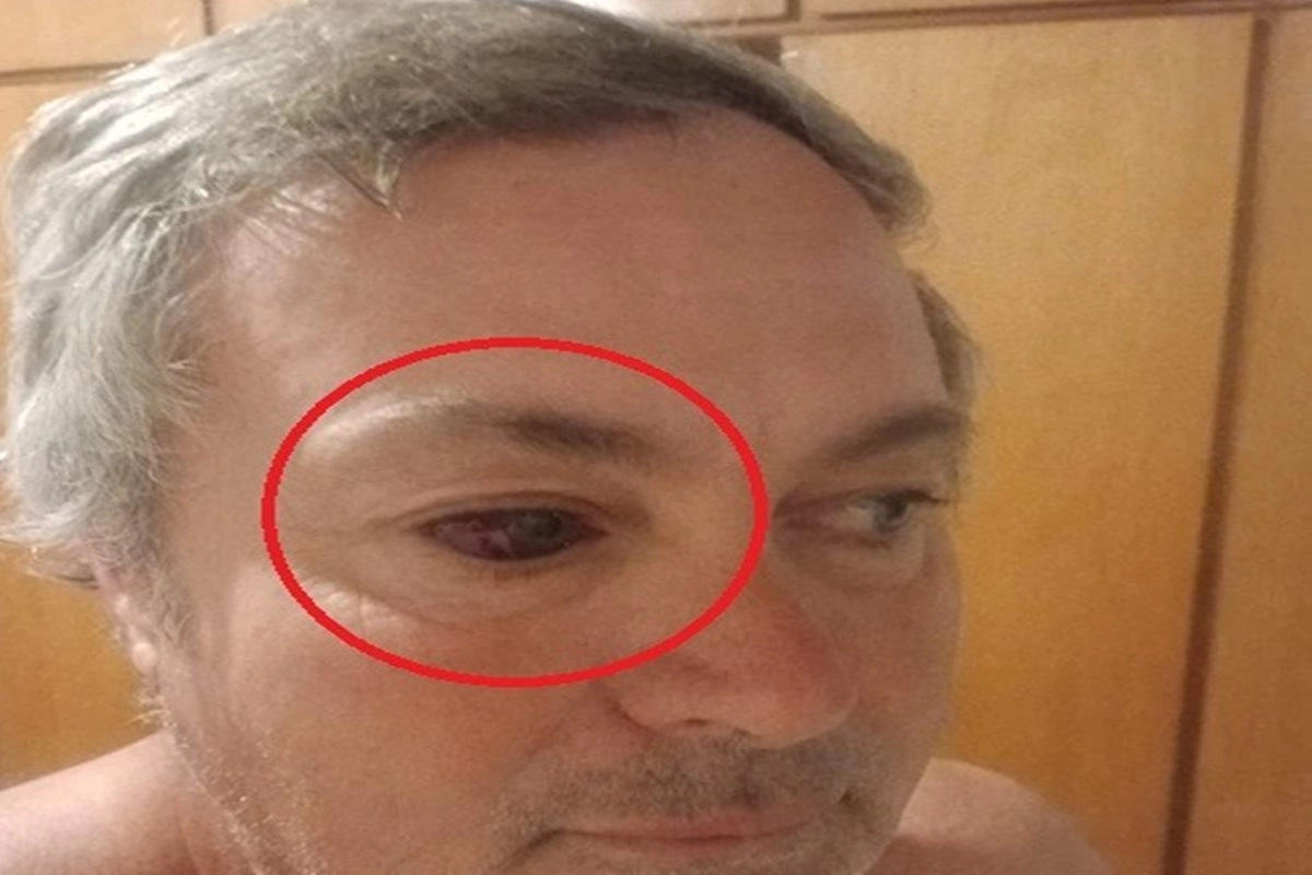 As&iacute; habr&iacute;a quedado el rostro del dirigente de Las Flores.